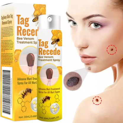 منتج القضاء على الثلاليل