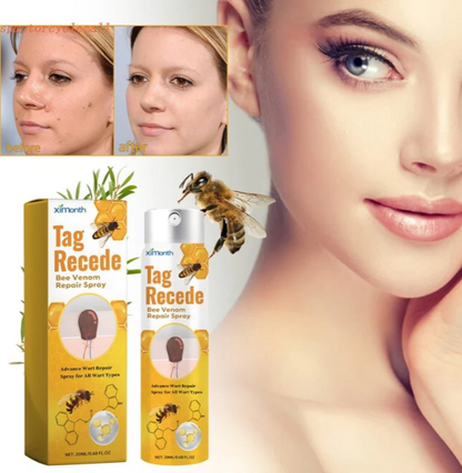 منتج القضاء على الثلاليل