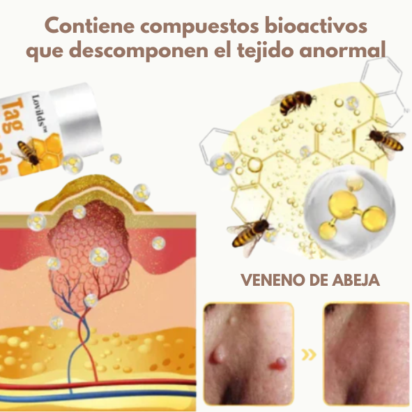 منتج القضاء على الثلاليل